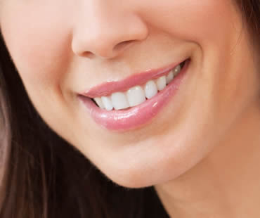 Teeth Whitening and Teeth Bleaching: What’s the Difference?