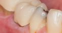 Private: Tips about Receding Gums